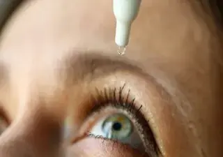 Una persona que sufre el síndrome de ojo seco utilizando lágrimas artificiales (Fuente: Clínica Baviera)